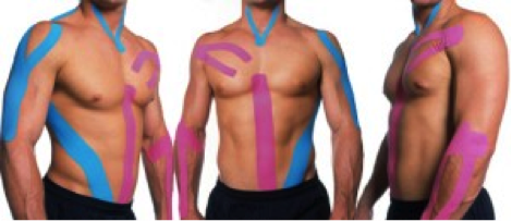 What is Kinesio Taping? - Arizona Orthopedic Physical Therapy